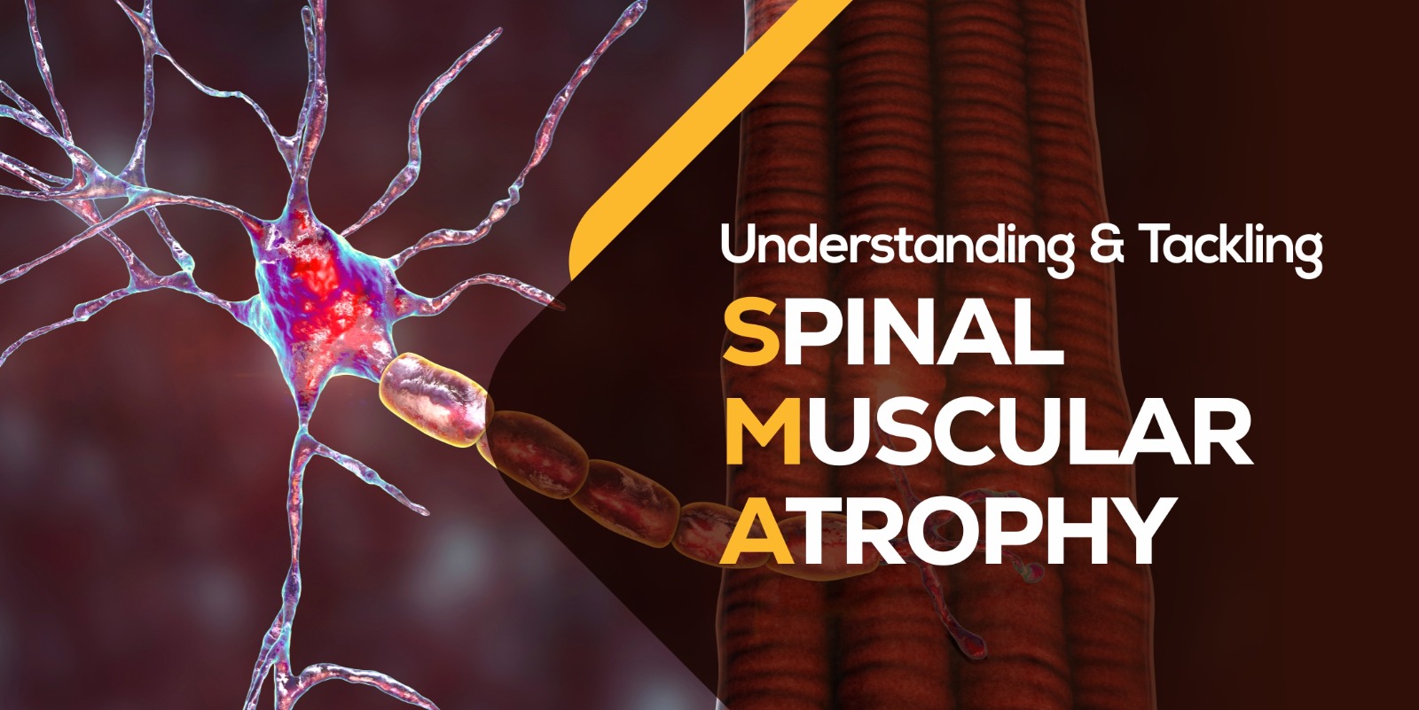 Understanding & Tackling Spinal Muscular Atrophy