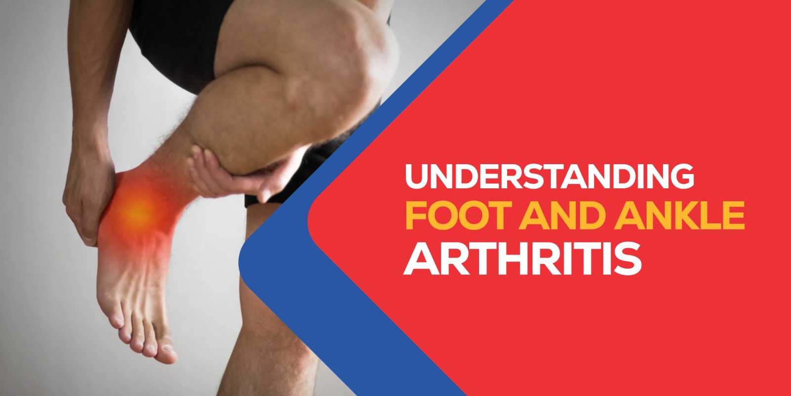 TAKING THE RIGHT STEPS – Understanding Arthritis of Foot and Ankle