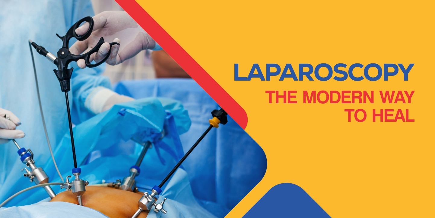 LAPAROSCOPY – THE MODERN WAY TO HEAL